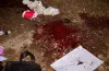 ракетний удар, загиблі, постраждалі