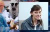 операція, нейрохірургія, пацієнтка, лікарі